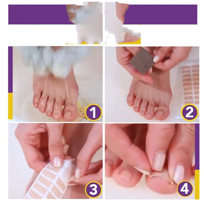 Nail Patch Correction