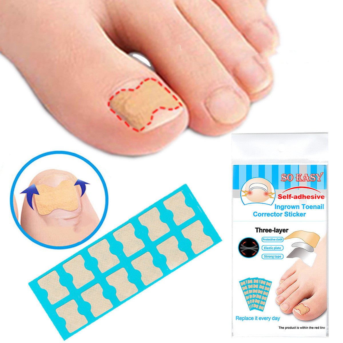 Nail Corrector Patch