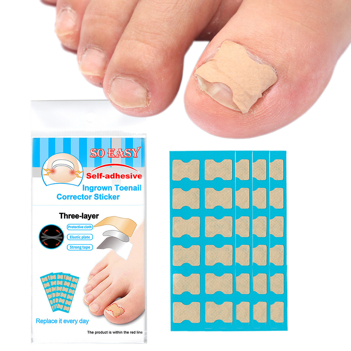 Nail Corrector Patch